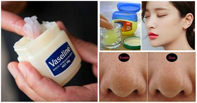20 công dụng làm đẹp “không ngờ” chỉ với 1 hũ Vaseline