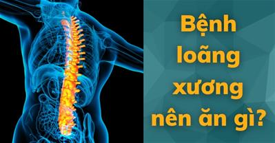 Bệnh loãng xương nên ăn gì? 5 loại thực phẩm vàng cho xương khớp