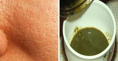 Cách làm se khít lỗ chân lông bằng nguyên liệu rẻ tiền