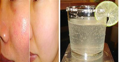 Cách làm se khít lỗ chân lông chỉ với 1 lon Soda 10k