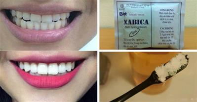 Cách làm trắng răng sau 1 tháng lên 2 tông chỉ với 20k