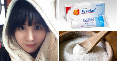 Cách trị mụn trứng cá từ Ánh Nguyệt sau 1 tháng với 30k