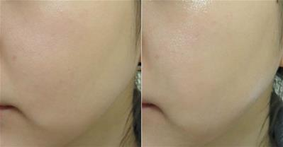 Chăm sóc toàn diện da dầu với mật ong tốt hơn mỹ phẩm