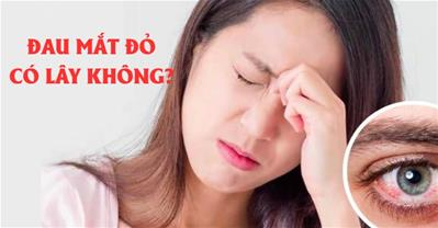 Đau mắt đỏ có lây không? Lây qua đường nào, cách phòng tránh