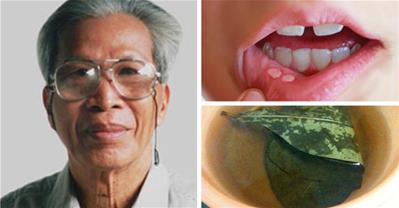 Giáo sư Tất Lợi chỉ cách trị nhiệt miệng sau 1 đêm