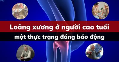 Loãng xương ở người cao tuổi và những vấn đề cần đặc biệt quan tâm