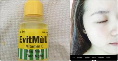Mặt láng mịn, không 1 nốt thâm nhờ chai dầu mù u 5k