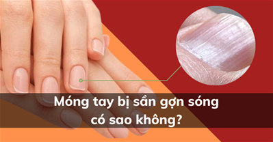 Móng tay bị sần gợn sóng là THIẾU CHẤT gì, phản ánh gì về sức khỏe?
