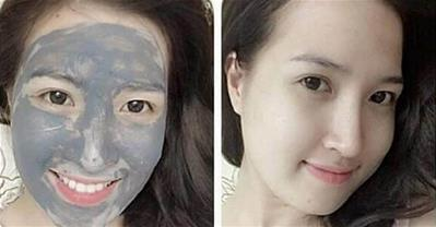 Sẹo thâm lâu năm cũng phải mờ 80% với mặt nạ đất sét