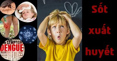 Sốt xuất huyết mấy ngày hết? Bị sốt xuất huyết có cần đi viện không?