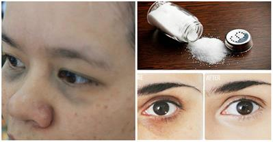 Tết xong mặt nổi đầy mụn thì dùng ngay loại mặt nạ này