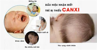 Thiếu canxi gây bệnh gì ở trẻ nhỏ? Cách bổ sung canxi cho bé an toàn