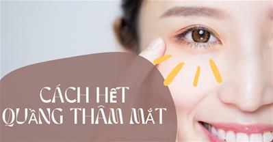 Thử ngay 10 cách hết quầng thâm mắt không tốn kém, đơn giản tại nhà