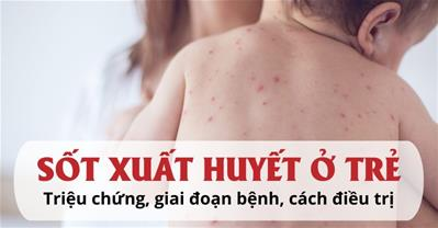 Triệu chứng sốt xuất huyết ở trẻ em nguy hiểm cần đi viện