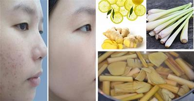 Tuyệt chiêu làm trắng da bằng cách xông hơi 