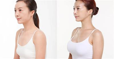 Vòng 1 căng tròn sau 2 tuần nhờ dùng thứ này mỗi ngày