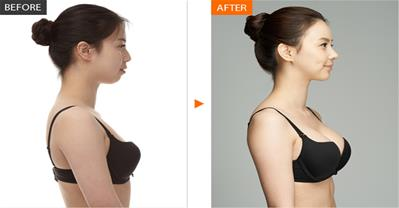 Vòng 1 lép kẹp cũng phải to ra nhờ uống thứ nước này